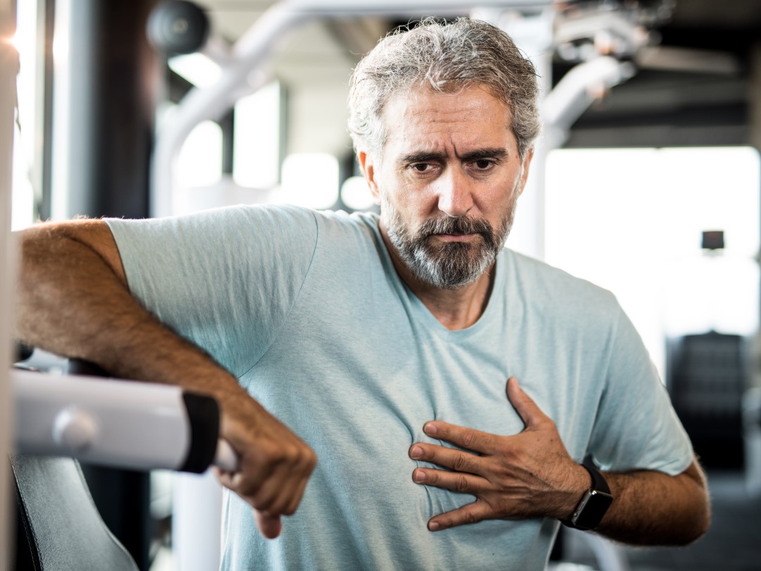 Atrial Fibrillation