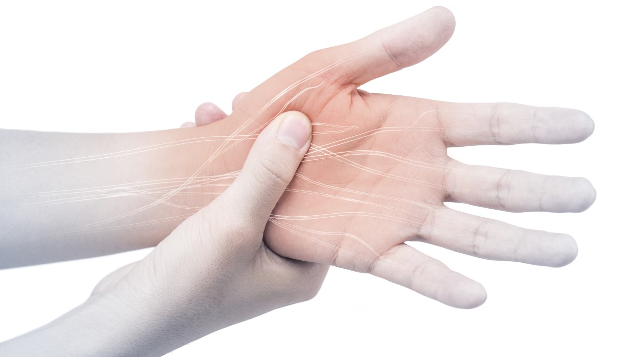 Carpal Tunnel Syndrome