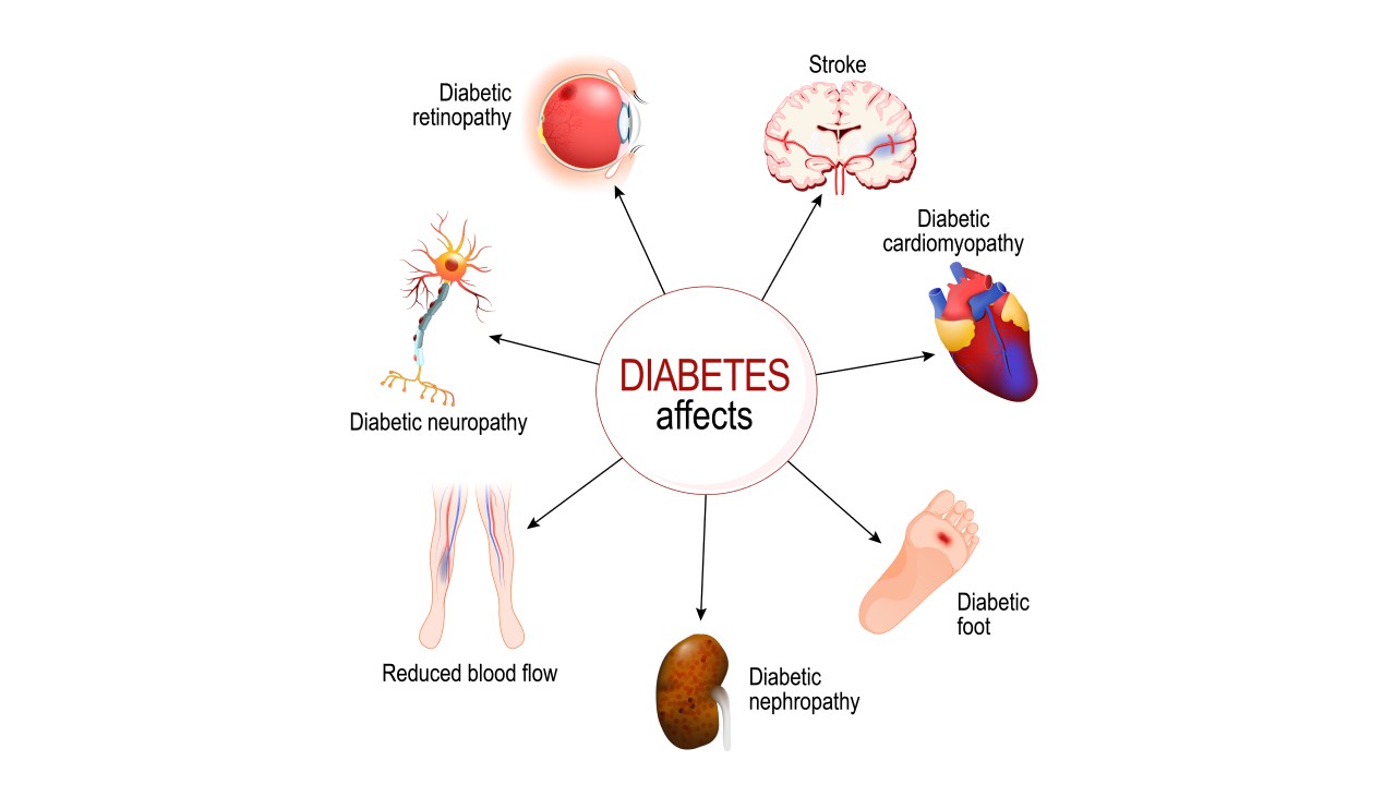 Diabetes (Part 2)