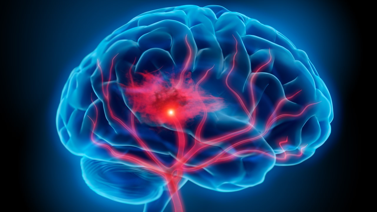 Integrative Treatment for Brain Injury (Part 1)