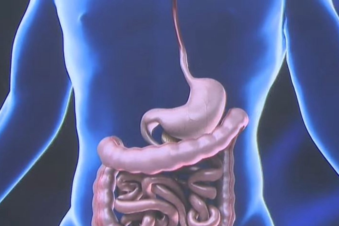 Salmonellosis