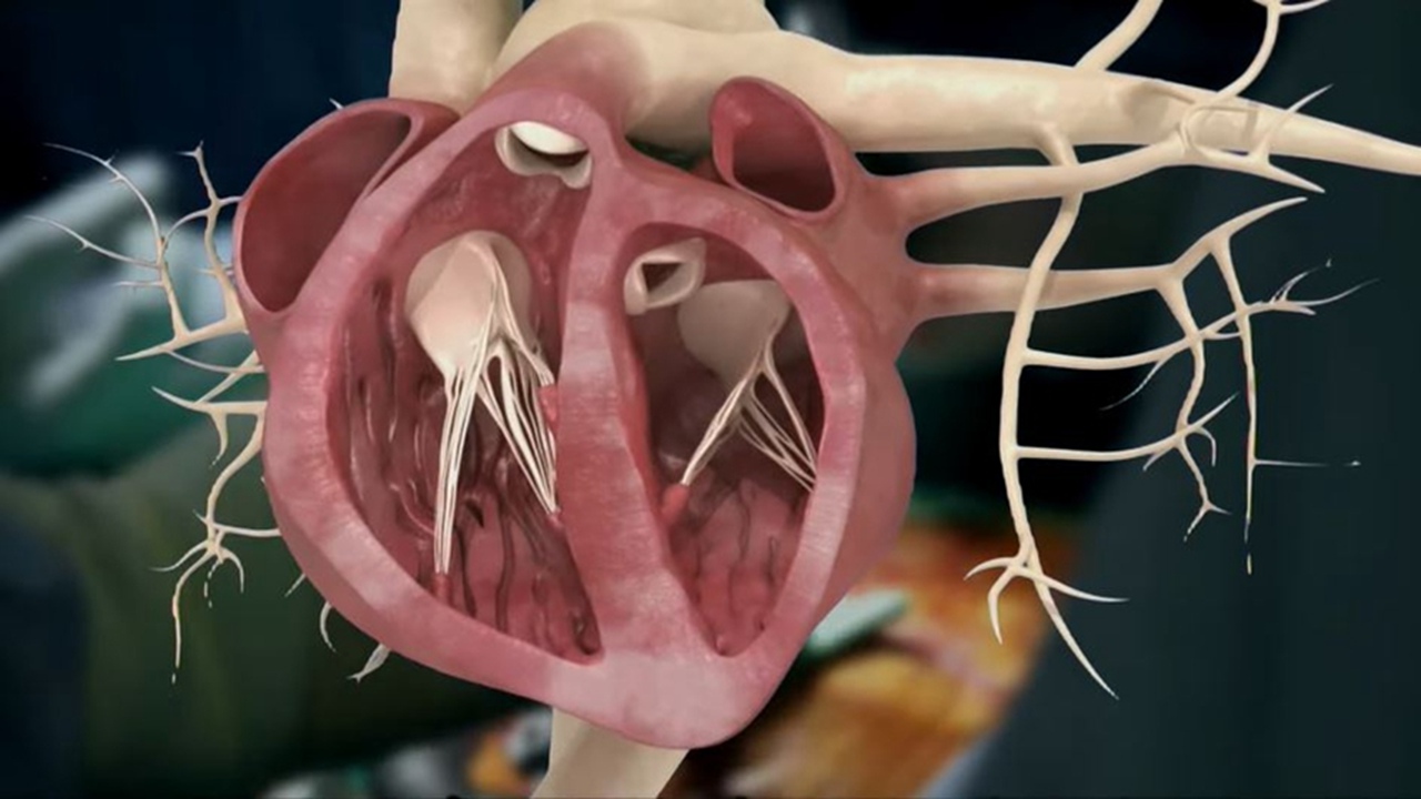 Heart Valve Disease