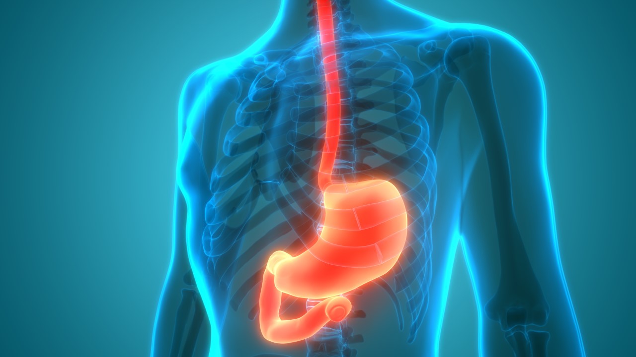 Duodenal Tumor