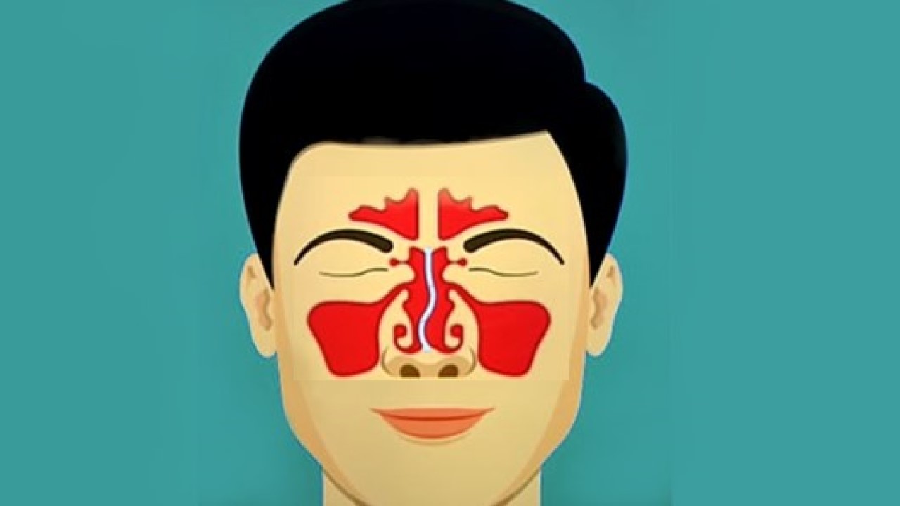 Nasal Septum Deviation
