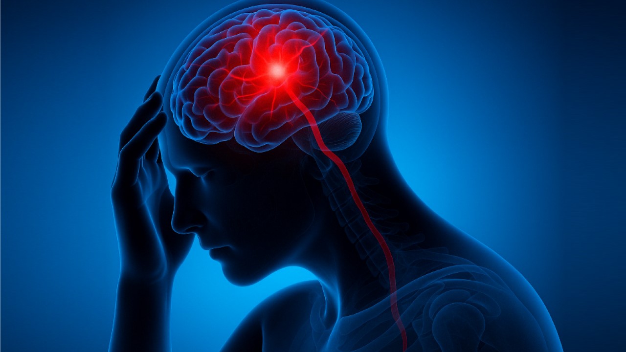 The Hidden Causes of Stroke