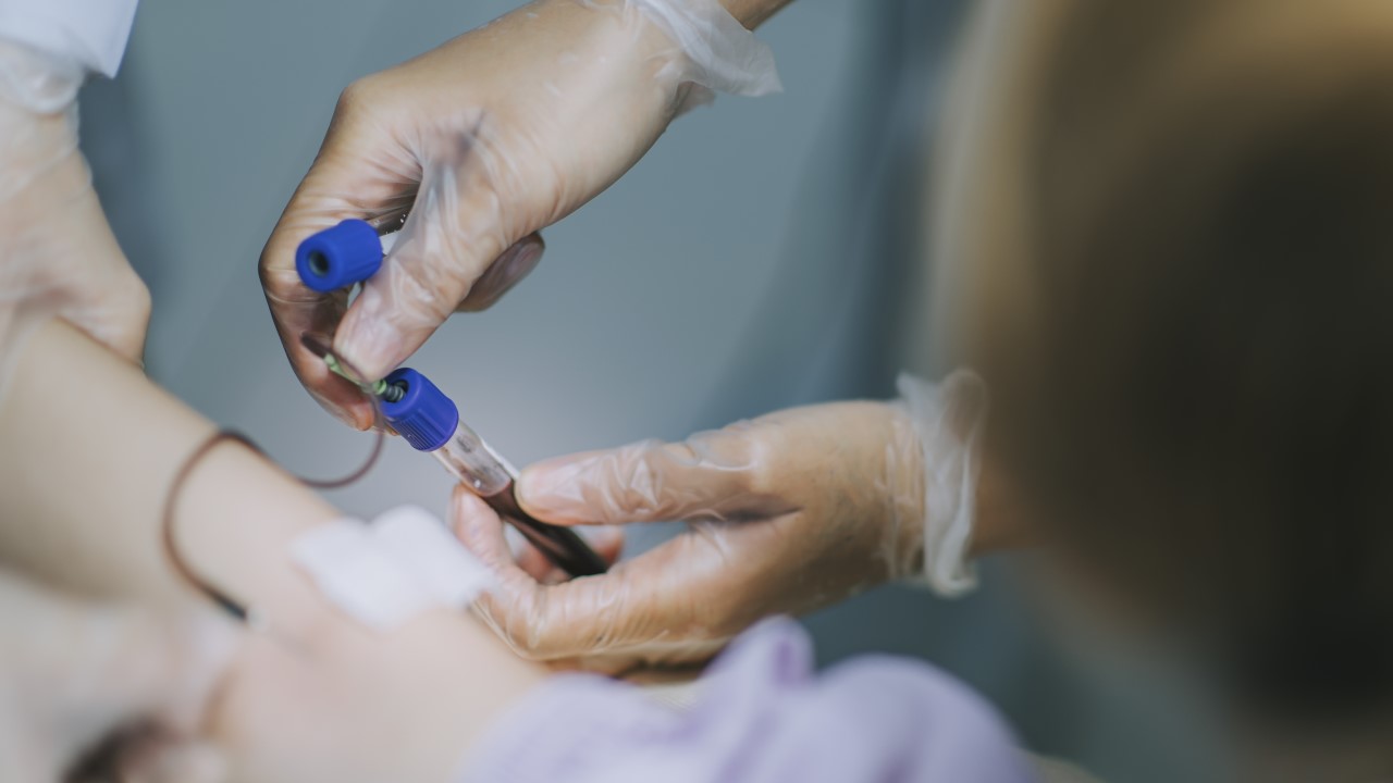 Dermatomyositis (Part 4)