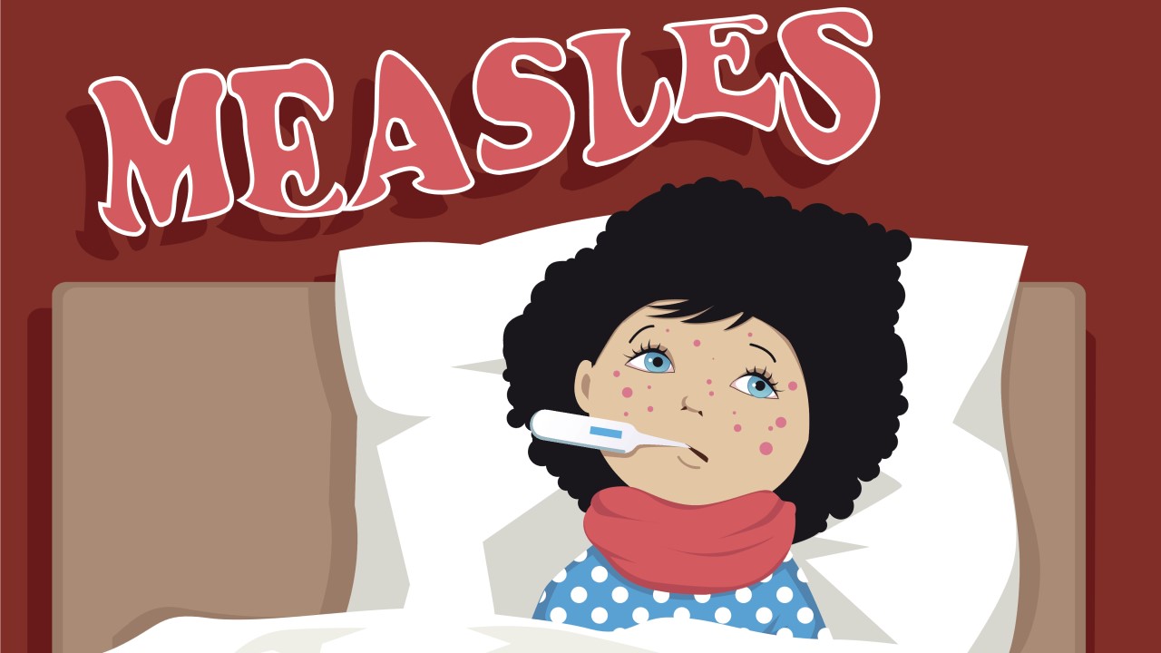 Measles (Part 1)
