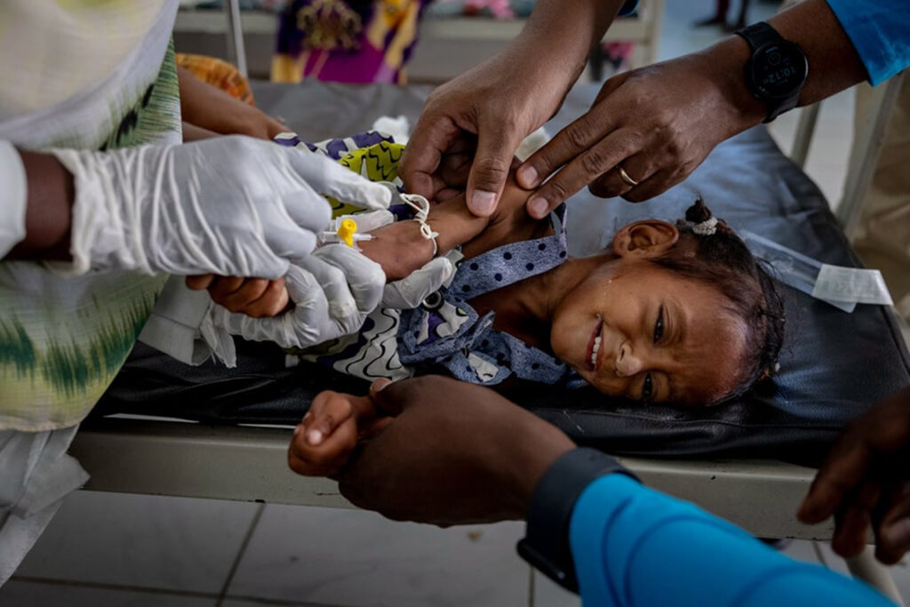 Doctors from UNICEF place a new intravenous cannula in Bara'a Ahmed at the malnutrition center in Port Sudan. Undiagnosed with cholera at the time, her condition later improved, and she was expected to survive.