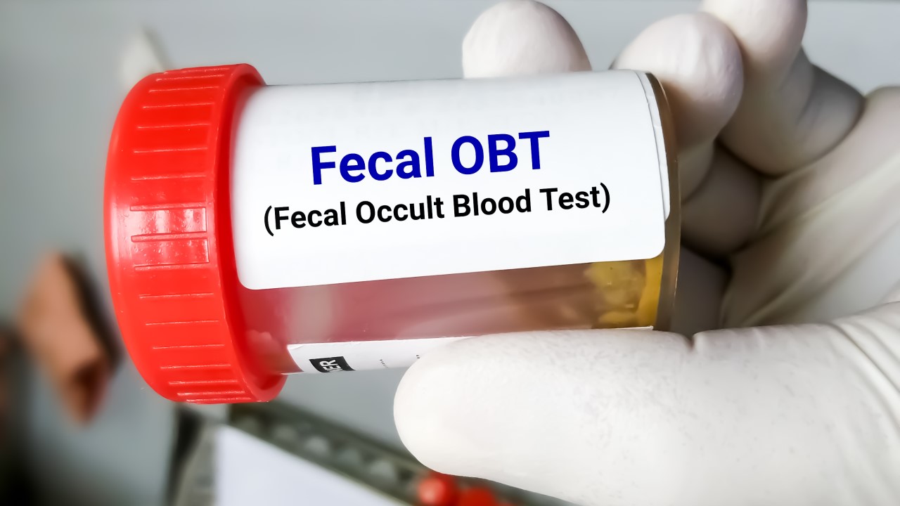 Fecal Occult Blood Test and Cancer