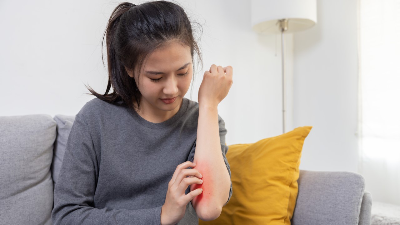 Combating Dampness with TCM Remedies