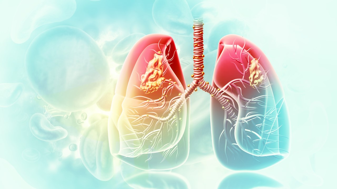 Food-based Remedies for Stronger Lungs